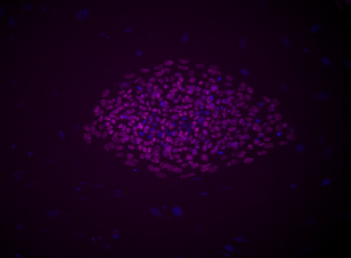 c6_oct3_647_Merged_H9_TDS.png